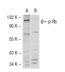  p-Rb (Thr 821/826)-R: sc-16669-R. Western blot analysis of Rb phosphorylation in untreated (A) and lambda protein phosphatase treated (B) SK-LMS-1 whole cell lysates.