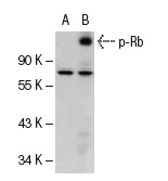  p-Rb (Thr 821/826): sc-16669. Western blot analysis of Rb phosphorylation in non-transfected: sc-117752 (A) and human Rb transfected: sc-114014 (B) 293T whole cell lysates.