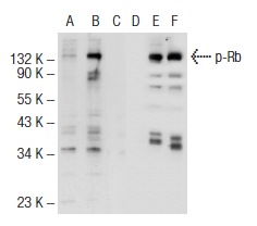  Western blot analysis of Rb phosphorylation in non-transfected: sc-117752 (A, D), untreated human Rb transfected: sc-114014 (B, E) and lambda protein phosphatase treated human Rb transfected: sc-114014 (C, F) 293T whole cell lysates.  Antibodies tested include p-Rb (Thr 821/826)-R: sc-16669-R (A, B, C) and Rb (M-153): sc-7905 (D, E, F).