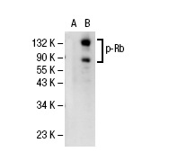  p-Rb (Tyr356) (7F10): sc-56175. Western blot analysis of phosphorylated Rb expression in non-transfected: sc-117752 (A) and human Rb transfected: sc-114014 (B) 293T whole cell lysates.