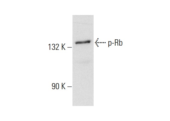  p-Rb (Tyr356) (7F10): sc-56175. Western blot analysis of Rb phosphorylation in K-562 whole cell lysate.