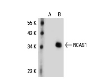  RCAS1 (N-18): sc-23394. Western blot analysis of RCAS1 expression in non-transfected: sc-110760 (A) and human RCAS1 transfected: sc-112757 (B) 293 whole cell lysates.