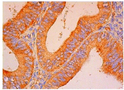  Reprimo (S-11): sc-136832. Immunoperoxidase staining of formalin fixed, paraffin-embedded human pre-menopausal uterus tissue showing cytoplasmic staining of glandular cells.