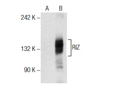  RIZ (N-20): sc-14228. Western blot analysis of RIZ expression in non-transfected: sc-117752 (A) and human RIZ transfected: sc-372474 (B) 293T whole cell lysates.