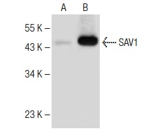  SAV1 (F-5): sc-374366. Western blot analysis of SAV1 expression in non-transfected: sc-117752 (A) and human SAV1 transfected: sc-113437 (B) 293T whole cell lysates.