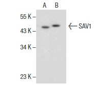  SAV1 (F-5): sc-374366. Western blot analysis of SAV1 expression in KNRK nuclear extract (A) and HCT 116 whole cell lysate (B).