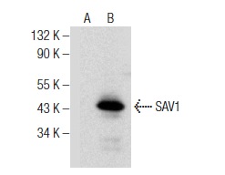  SAV1 (H-200): sc-135394. Western blot analysis of SAV1 expression in non-transfected: sc-117752 (A) and mouse SAV1 transfected: sc-123362 (B) 293T whole cell lysates.