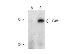  SAV1 (H-200): sc-135394. Western blot analysis of SAV1 expression in non-transfected: sc-117752 (A) and human SAV1 transfected: sc-113437 (B) 293T whole cell lysates.