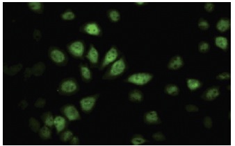  SAV1 (JJ-6): sc-101205. Immunofluorescence staining of paraformaldehyde-fixed HeLa cells showing nuclear and cytoplasmic localization.