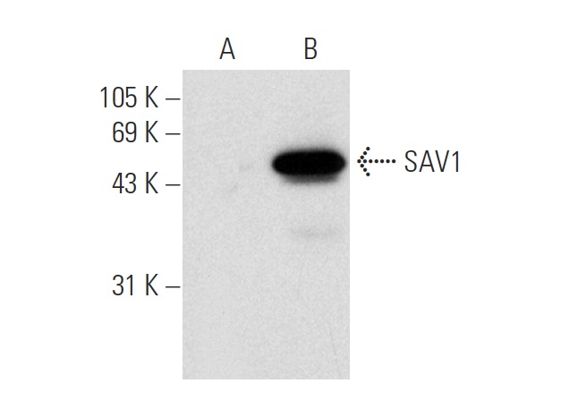  SAV1 (JJ-6): sc-101205. Western blot analysis of SAV1 expression in non-transfected: sc-117752 (A) and human SAV1 transfected: sc-113437 (B) 293T whole cell lysates.