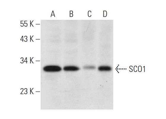  SCO1 (D-1): sc-398001. Western blot analysis of SCO1 expression in Hep G2 (A), HeLa (B) and IMR-32 (D) whole cell lysates and human liver tissue extract (C).