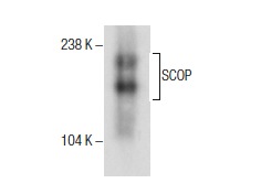  SCOP (H-3): sc-390129. Western blot analysis of SCOP expression in Y79 nuclear extract.