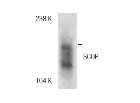  SCOP (H-3): sc-390129. Western blot analysis of SCOP expression in HCT 116 whole cell lysate.