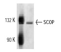  SCOP (K-20): sc-46451. Western blot analysis of SCOP expression in Y79 nuclear extract.