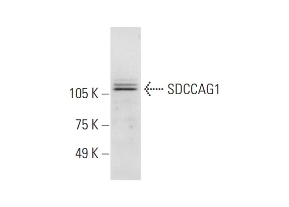  SDCCAG1 (E-16): sc-244092. Western blot analysis of SDCCAG1 expression in Jurkat whole cell lysate.