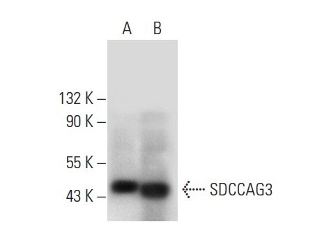  SDCCAG3 (E-2): sc-398909. Western blot analysis of SDCCAG3 expression in MOLT-4 whole cell lysate (A) and human pancreas tissue extract (B).