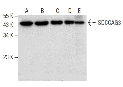  SDCCAG3 (E-2): sc-398909. Western blot analysis of SDCCAG3 expression in A549 (A), HEK293T (B) and RT-4 (C) whole cell lysates and mouse brain (D) and mouse pancreas (E) tissue extracts.