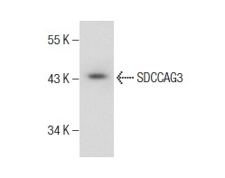  SDCCAG3 (E-16): sc-169266. Western blot analysis of SDCCAG3 expression in mouse pancreas tissue extract.