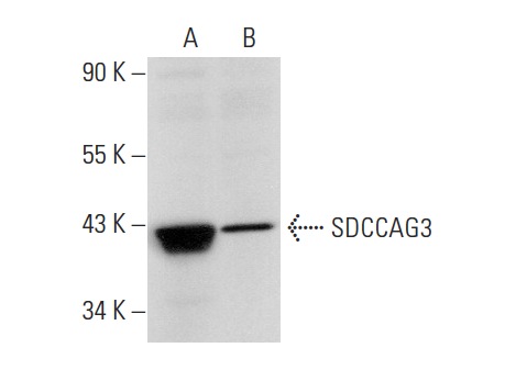  SDCCAG3 (E-16): sc-169266. Western blot analysis of SDCCAG3 expression in A549 (A) and HEK293 (B) whole cell lysates.