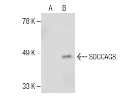  SDCCAG8 (N-16): sc-137753. Western blot analysis of SDCCAG8 expression in non-transfected: sc-117752 (A) and mouse SDCCAG8 transfected: sc-123401 (B) 293T whole cell lysates.