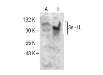  Sel-1L (F-3): sc-377350. Western blot analysis of Sel-1L expression in SK-BR-3 (A) and SCC-4 (B) whole cell lysates.