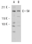  Sil (T-16): sc-32619. Western blot analysis of Sil expression in K-562 (A) and HEL 92.1.7 (B) whole cell lysates.