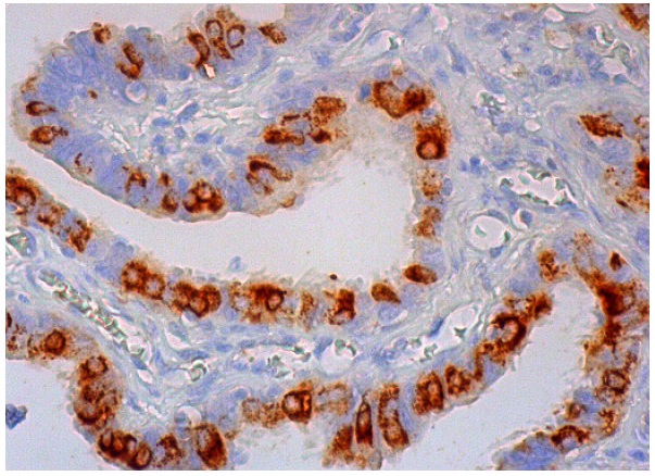  SODD (N-19): sc-9179. Immunoperoxidase staining of formalin fixed, paraffin-embedded human fallopian tube tissue showing cytoplasmic staining of glandular cells.