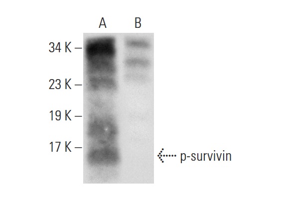  p-survivin (Thr 34)-R: sc-23758-R. Western blot analysis of survivin phosphorylation in untreated (A) and lambda protein phosphatase treated (B) HL-60 whole cell lysates.