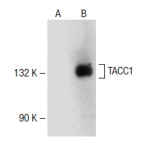  TACC1 (C-18): sc-5882. Western blot analysis of TACC1 expression in non-transfected: sc-110760 (A) and mouse TACC1 transfected: sc-179572 (B) 293 whole cell lysates.