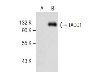  TACC1 (E-3): sc-377373. Western blot analysis of TACC1 expression in non-transfected: sc-110760 (A) and mouse TACC1 transfected: sc-179572 (B) 293 whole cell lysates.