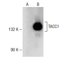  TACC1 (G-18): sc-5881. Western blot analysis of TACC1 expression in non-transfected: sc-110760 (A) and mouse TACC1 transfected: sc-179572 (B) 293 whole cell lysates.