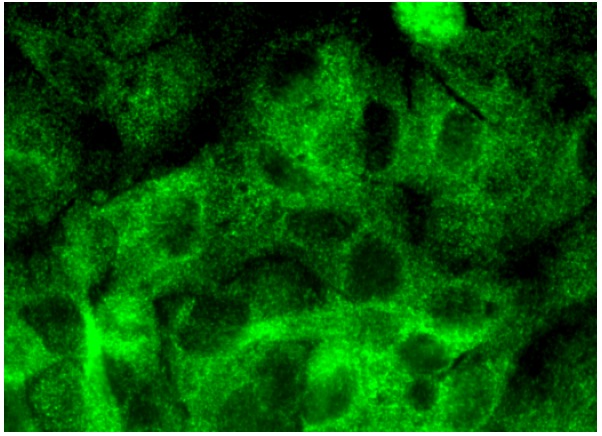  TANK (D-2): sc-166643. Immunofluorescence staining of formalin-fixed HepG2 cells showing cytoplasmic localization.