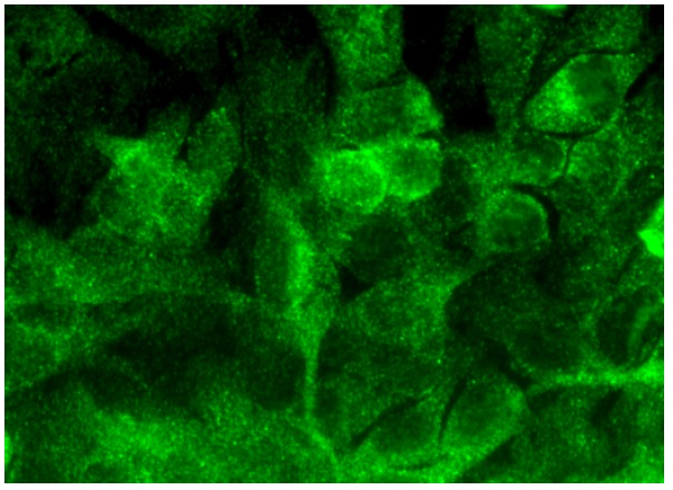  TANK (A-7): sc-166642. Immunofluorescence staining of formalin-fixed HepG2 cells showing cytoplasmic localization.