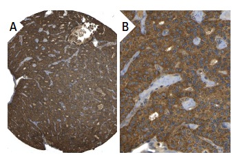  TANK (H-300): sc-8314. Immunoperoxidase staining of formalin fixed, paraffin-embedded human parathyroid gland tissue showing cytoplasmic staining of glandular cells (low and high magnification). Kindly provided by The Swedish Human Protein Atlas (HPA) program.