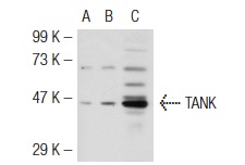  TANK (H-300): sc-8314. Western blot analysis of TANK expression in non-transfected 293T: sc-117752 (A), mouse TANK transfected 293T: sc-127629 (B) and HCT 116 (C) whole cell lysates.