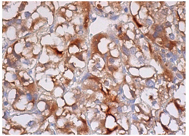  TANK (H-300): sc-8314. Immunoperoxidase staining of formalin fixed, paraffin-embedded human adrenal gland tissue showing cytoplasmic staining of glandular cells.