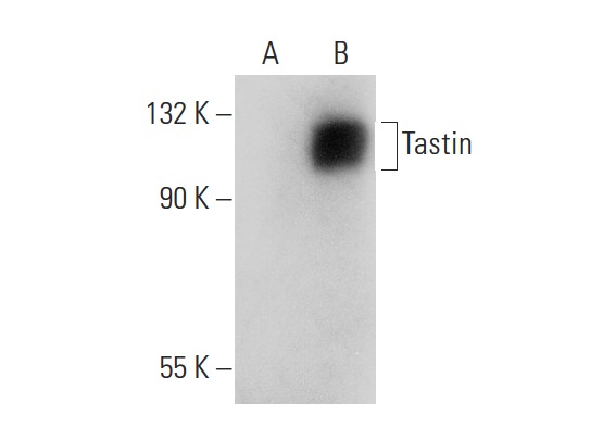  Tastin (M-230): sc-135271. Western blot analysis of Tastin expression in non-transfected: sc-117752 (A) and human Tastin transfected: sc-115239 (B) 293T whole cell lysates.