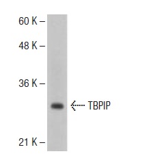  TBPIP (T-21): sc-134056. Western blot analysis of TBPIP expression in Hep G2 whole cell lysate.