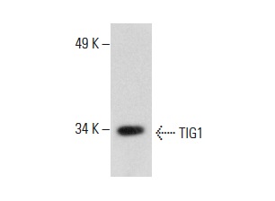  TIG1 (G-2): sc-390461. Western blot analysis of TIG1 expression in HeLa whole cell lysate.