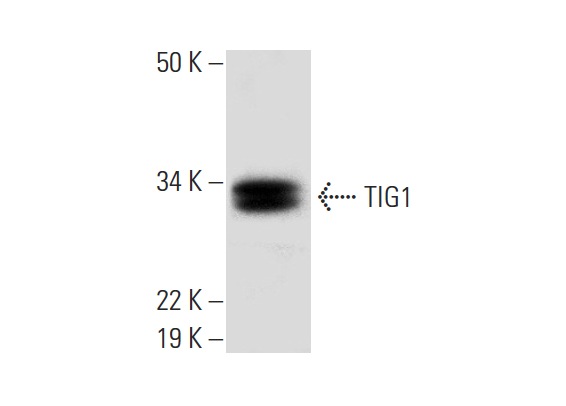  TIG1 (G-2): sc-390461. Western blot analysis of TIG1 expression in HL-60 whole cell lysate.