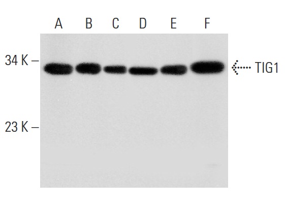  TIG1 (G-2): sc-390461. Western blot analysis of TIG1 expression in rat liver tissue extract (A) and HeLa (B), HEK293 (C), Hep G2 (D), CCRF-CEM (E) and A549 (F) whole cell lysates.