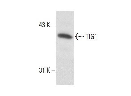  TIG1 (H-200): sc-98965. Western blot analysis of TIG1 expression in HeLa whole cell lysate.