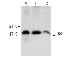  TIG2 (E-7): sc-373797. Western blot analysis of TIG2 expression in human lung (A), human heart (B) and human liver (C) tissue extracts.