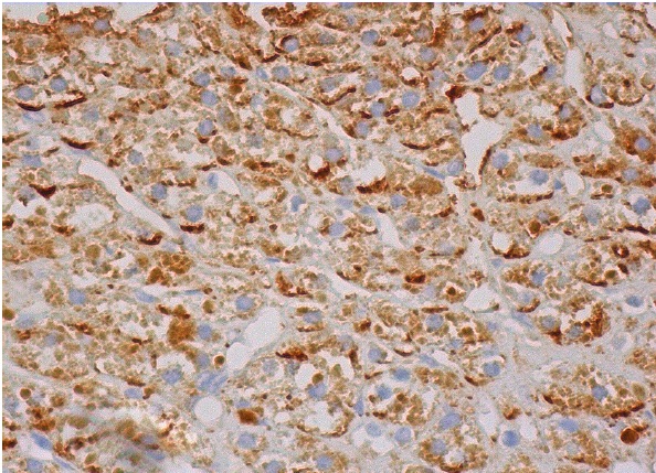  TIG2 (E-7): sc-373797. Immunoperoxidase staining of formalin fixed, paraffin-embedded human adrenal gland tissue showing cytoplasmic staining of glandular cells.