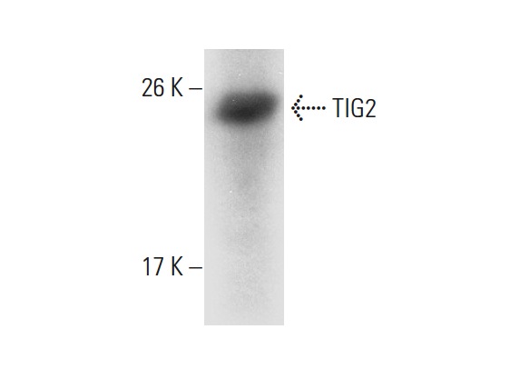  TIG2 (H-143): sc-135254. Western blot analysis of TIG2 expression in human testis (A) and human lung (B) tissue extracts.