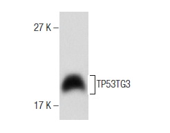  TP53TG3 (P-20): sc-249070. Western blot analysis of TP53TG3 expression in HeLa whole cell lysate.