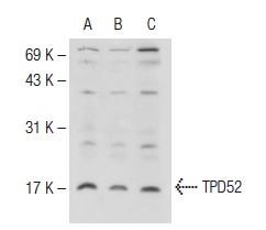  TPD52 (H-45): sc-67063. Western blot analysis of TPD52 expression in Raji (A), BJAB (B) and Ramos (C) whole cell lysates.