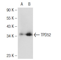  TPD52 (A-6): sc-166732. Western blot analysis of TPD52 expression in non-transfected: sc-110760 (A) and human TPD52 transfected: sc-113261 (B) 293 whole cell lysates.