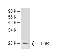  TPD52 (K-17): sc-33843. Western blot analysis of TPD52 expression in mouse lymph node tissue extract.