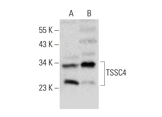  TSSC4 (G-12): sc-136945. Western blot analysis of TSSC4 expression in HeLa (A) and LADMAC (B) whole cell lysates.